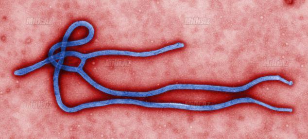 Fransada Ebola həyəcanı - İlk yoluxma halı qeydə alındı